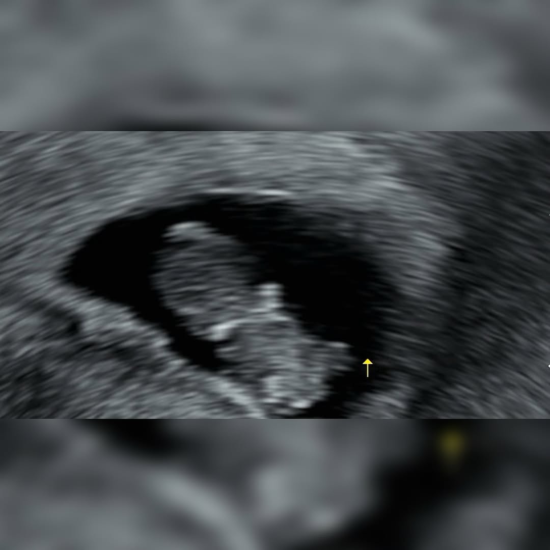 Foto sonogram janin Yuna dalam kandungan / Foto : soompi