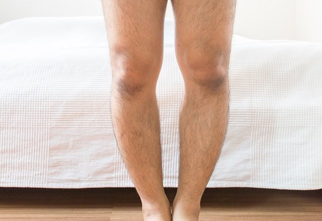ilustrasi / Foto: Alodokter