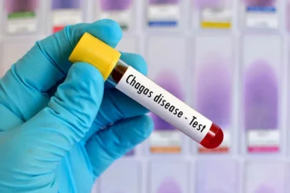 Ilustrasi penyakit Chagas/ Foto: national today