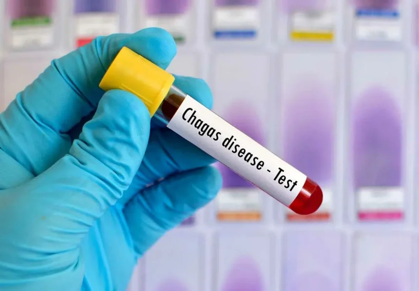Ilustrasi penyakit Chagas/ Foto: national today